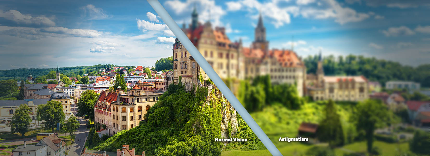 Astigmatism Treatment in Spring